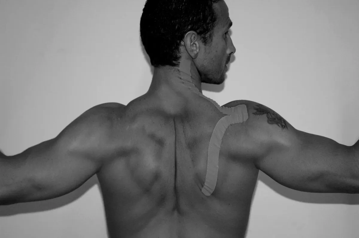 Bendaggio Neuromuscolare